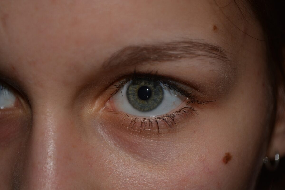 Tout_savoir_sur_les_grains_de_beauté_visage_:_une_question_de_santé_